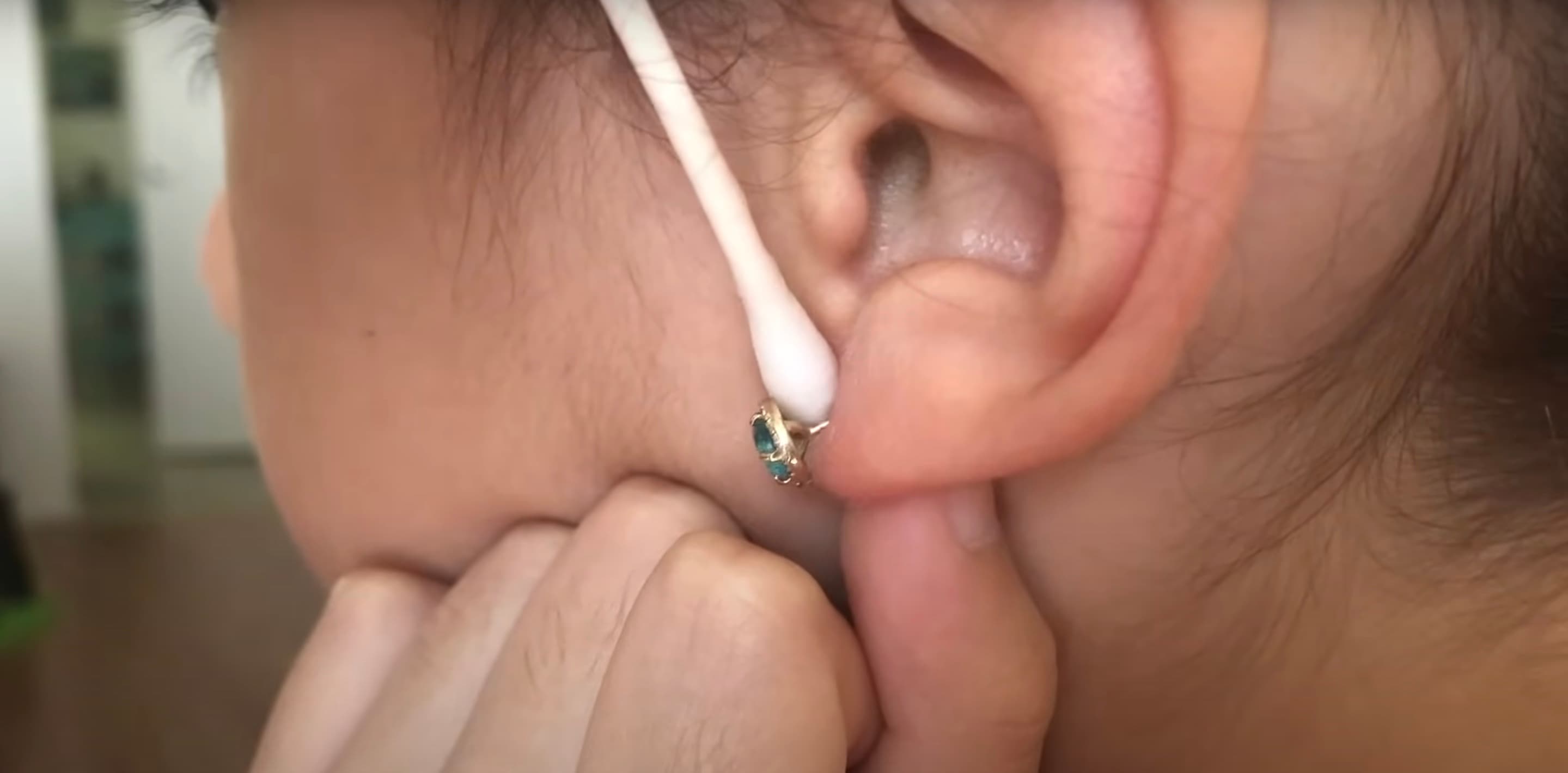 Reinigung des Piercinglochs